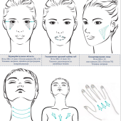 Neuramis Lidocaine - Нейрамис Лидокаин