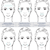 Neuramis Light Lidocaine - Нейрамис Лайт с лидокаином 