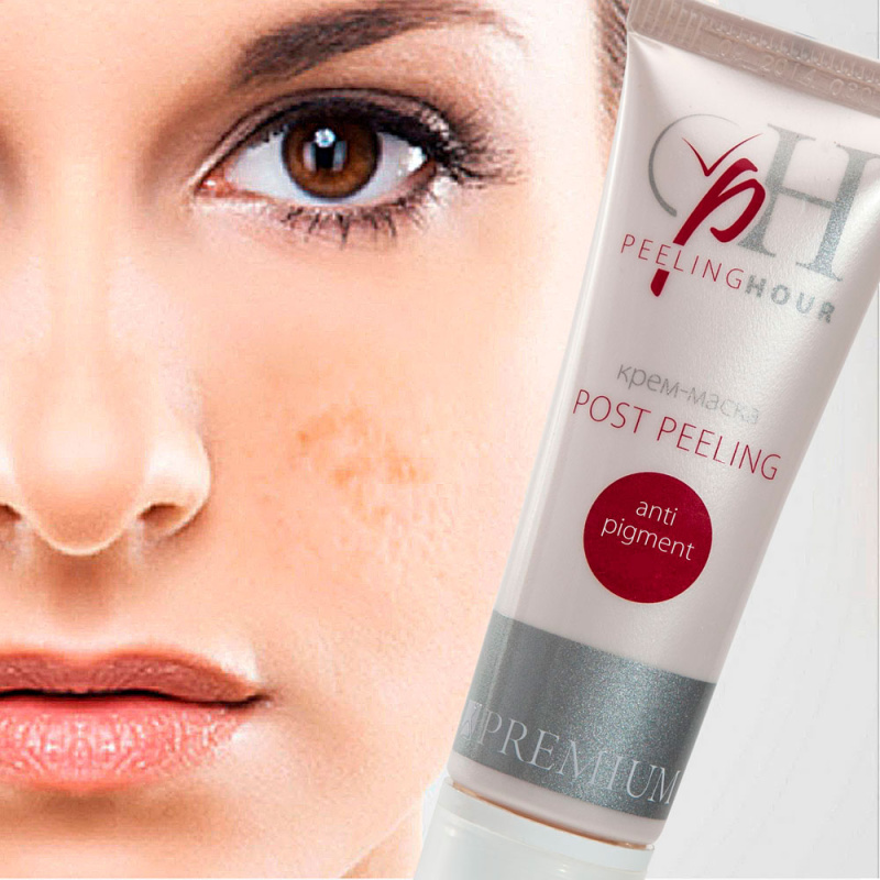 Крем-маска Post Peeling Anti-pigment