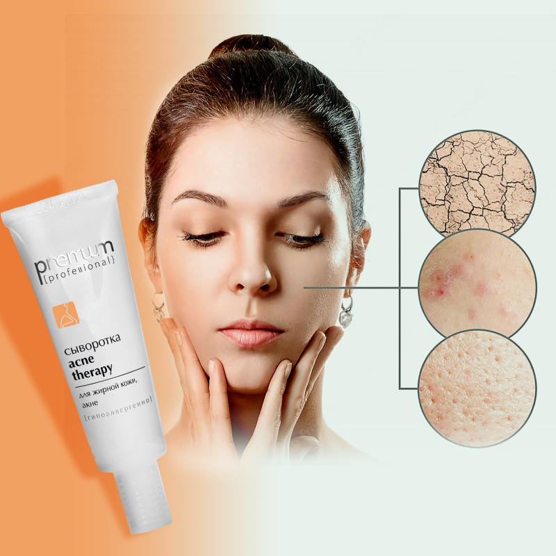 Сыворотка  Acne Therapy 